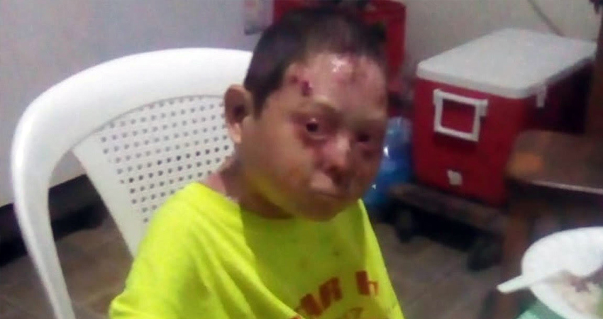 José Danilo, quien padece lupus, es uno de los pequeños estafados. Foto: Cortesía/Radio ABC Stereo