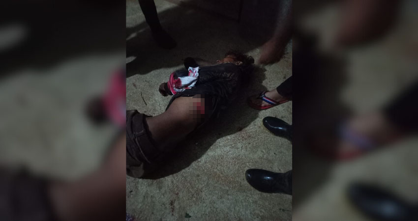Marcos Blandón resultó con heridas en el costado y uno de sus pies. Foto: Cortesía/Radio ABC Stereo