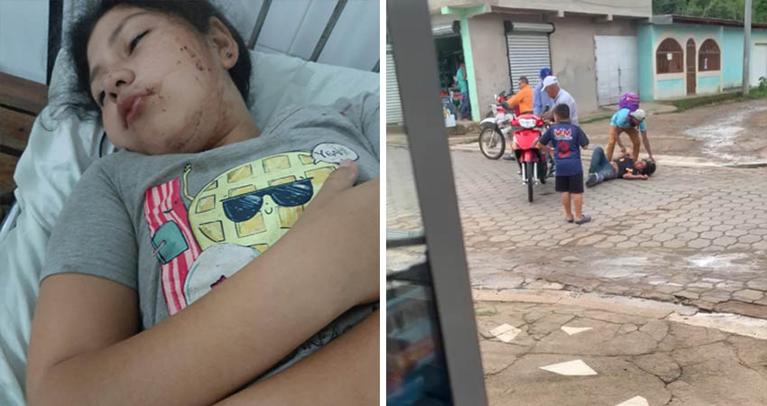 La madre de la víctima, demanda que el motociclista se responsabilice por los daños. Foto: Cortesía/Radio ABC Stereo