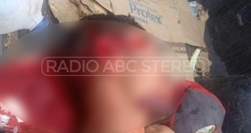 Una de las heridas más graves fue en su rostro. Foto: Cortesía/Radio ABC Stereo