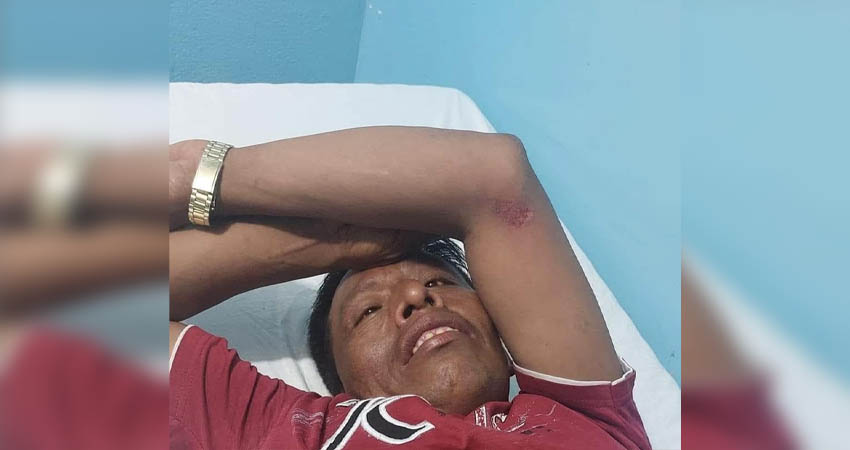 El accidente ocurrió en la carretera que conduce hacia san Sebastián de Yali, Jinotega. Foto: Condega Digital Noticias