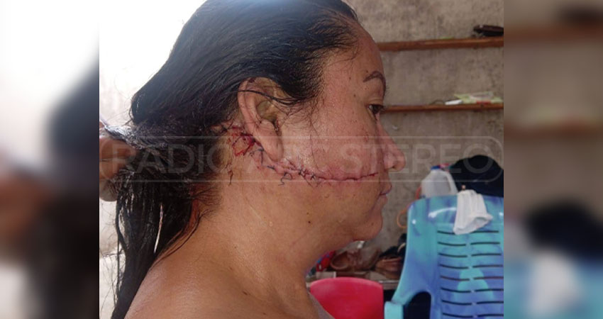 El hecho ocurrió en un bar de Mozonte. Foto: Cortesía/Radio ABC Stereo