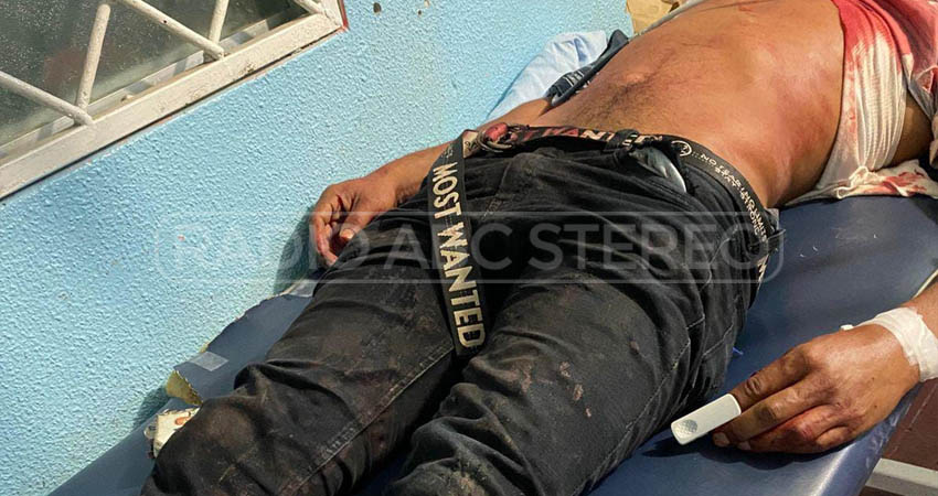 Arlen Tercero Tercero, de unos 30 años, fue herido en el rostro. Foto: Cortesía/Radio ABC Stereo