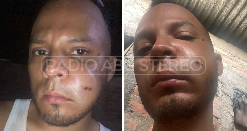 La víctima espera que se reparen los daños causados. Foto: Cortesía/Radio ABC Stereo