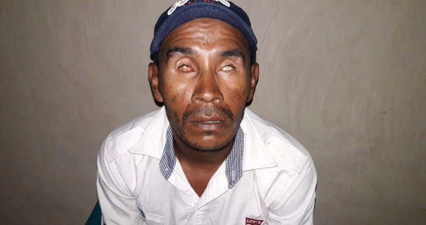 Noel de Jesús vive en La Baronesa, Condega. Foto: Cortesía/Radio ABC Stereo