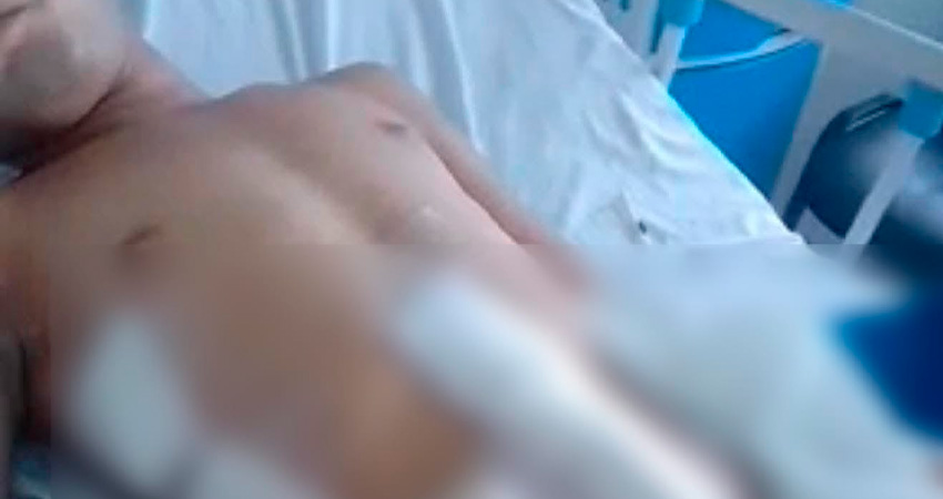 La víctima tuvo que ser remitida al hospital Héroes de las Segovias por la gravedad de sus heridas. Foto: Cortesía/Radio ABC Stereo