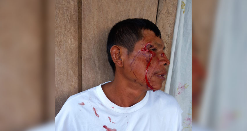 El conductor lo dejó tirado en la carretera. Foto: Cortesía/Radio ABC Stereo