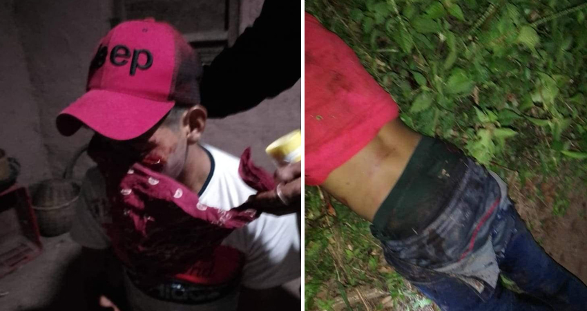 El hecho ocurrió en la comunidad La Montañita. Foto: Cortesía/Radio ABC Stereo