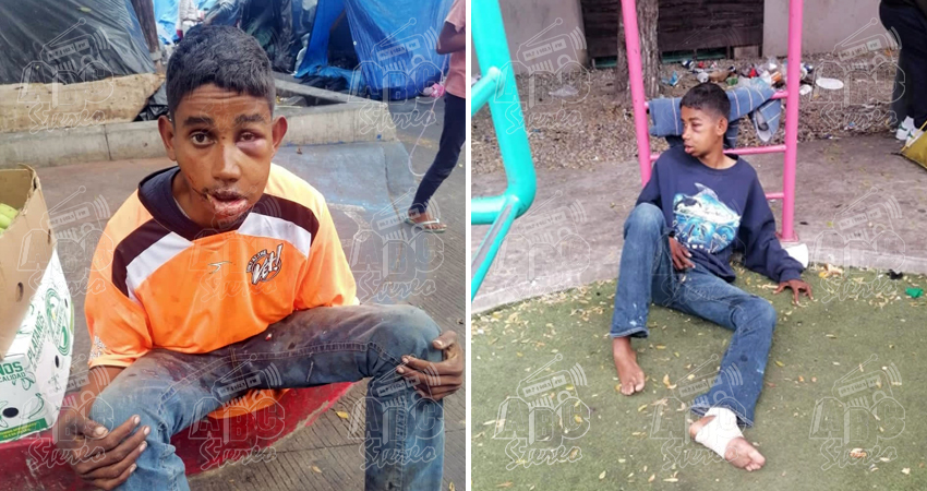 Ramón Obed Ruíz fue encontrado gravemente herido por un hondureño en Tijuana, Baja California. Foto: Cortesía/Radio ABC Stereo