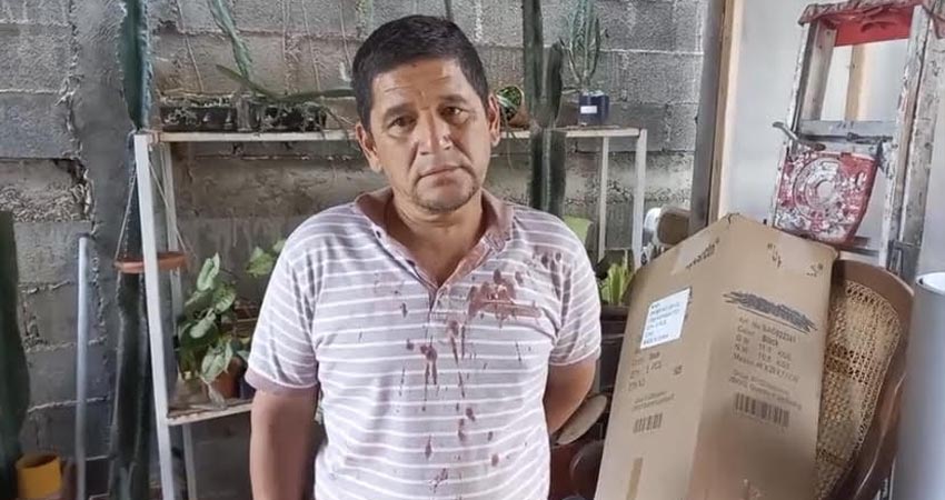 El afectado sufrió una herida en la cabeza y otra bajo la barba. Foto: Informativo 24/7 Jinotega